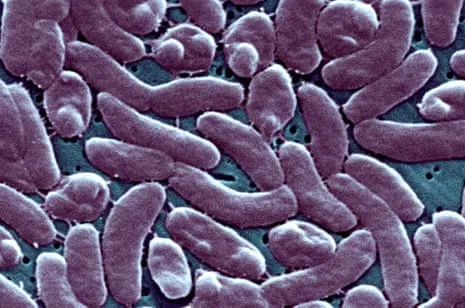 The Bayou State Reports Five Deaths from Necrotizing Bacterium in Coastal Waters